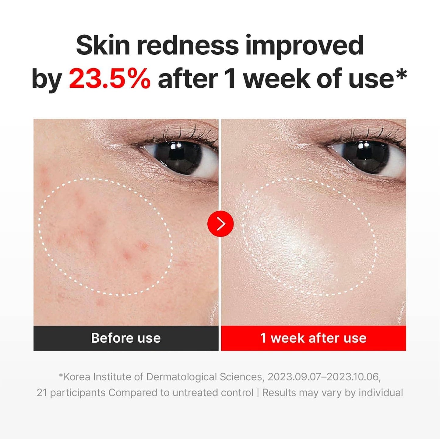 Centellian 24 Madeca Time Reverse Korean Cream
